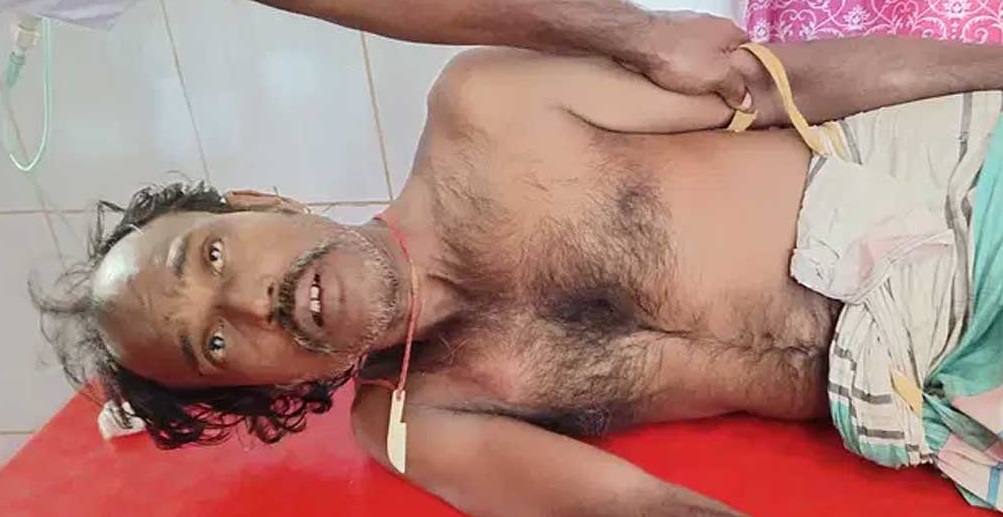 কামড় খেয়ে জীবিত গোখরা নিয়েই হাসপাতালে সাপুড়ে